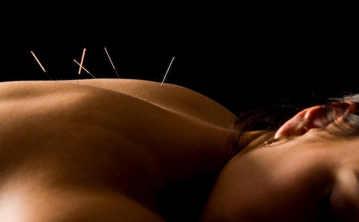 Acupuncture et syndrome de l'intestin irritable